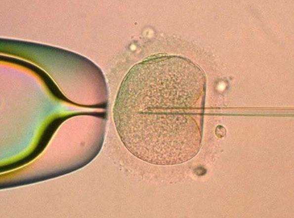 昆明代怀孕官网,试管婴儿是冻胚好还是囊胚好-上海供卵试管公司有哪些-非正常